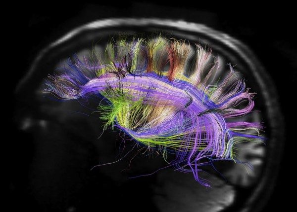 human-brain-120329-e1333557696509-3555905