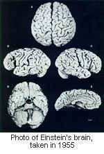 einstein-brain-1402508